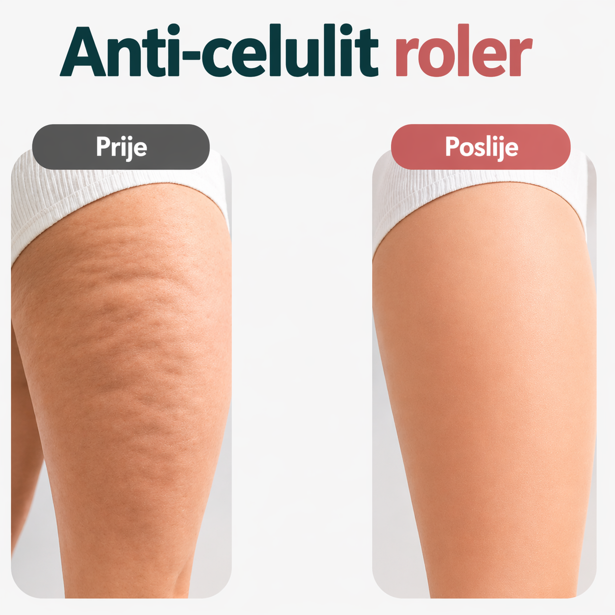 Anti-celulit roler